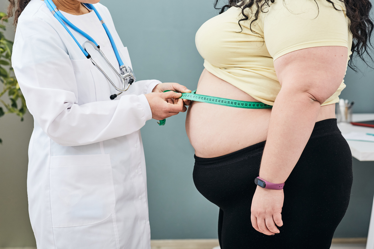Morbid obesity: BMI, consequences, management