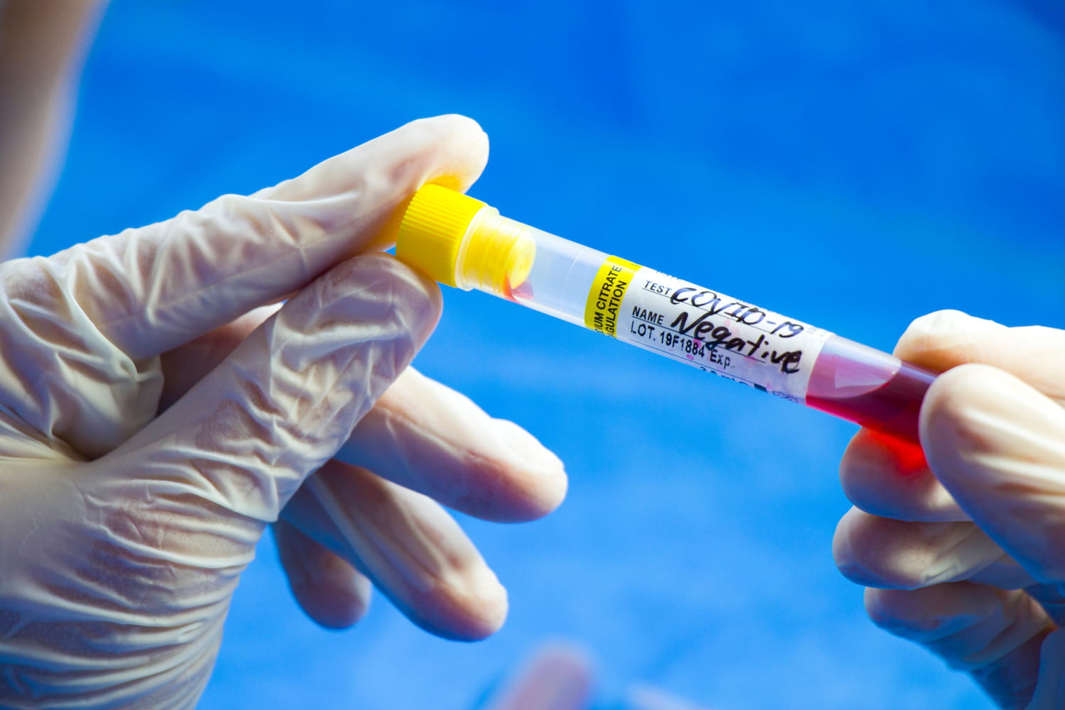 Covid France figures: epidemic still declining as of May 20