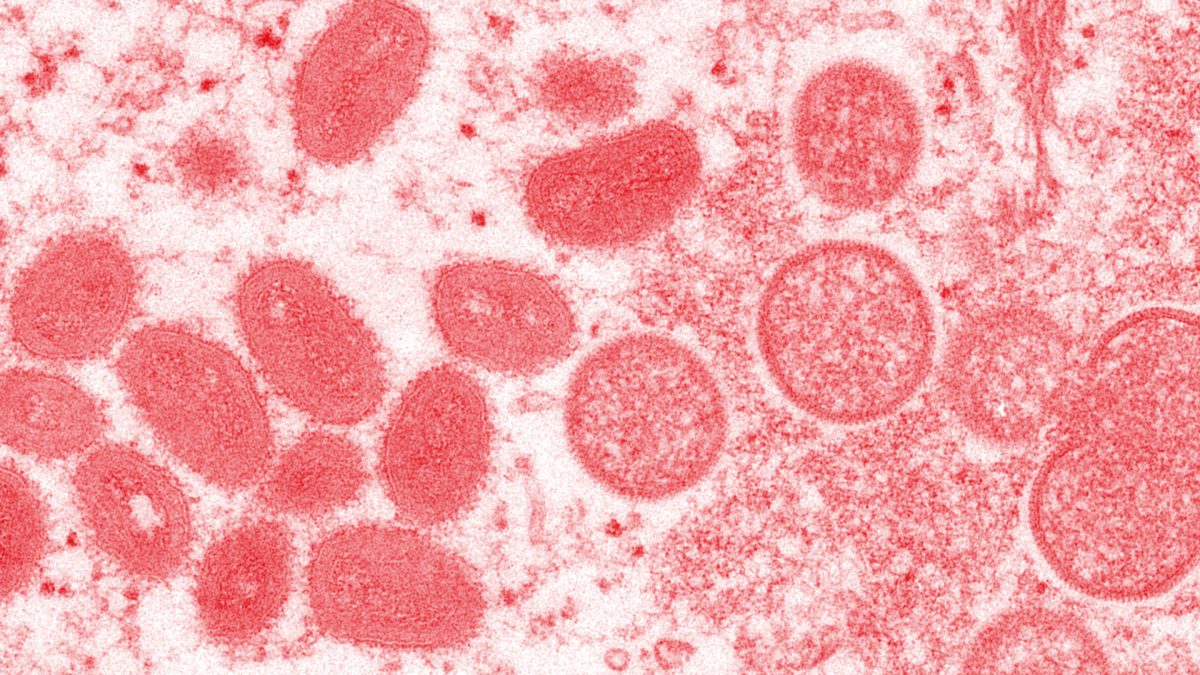 Monkey pox: what you need to know