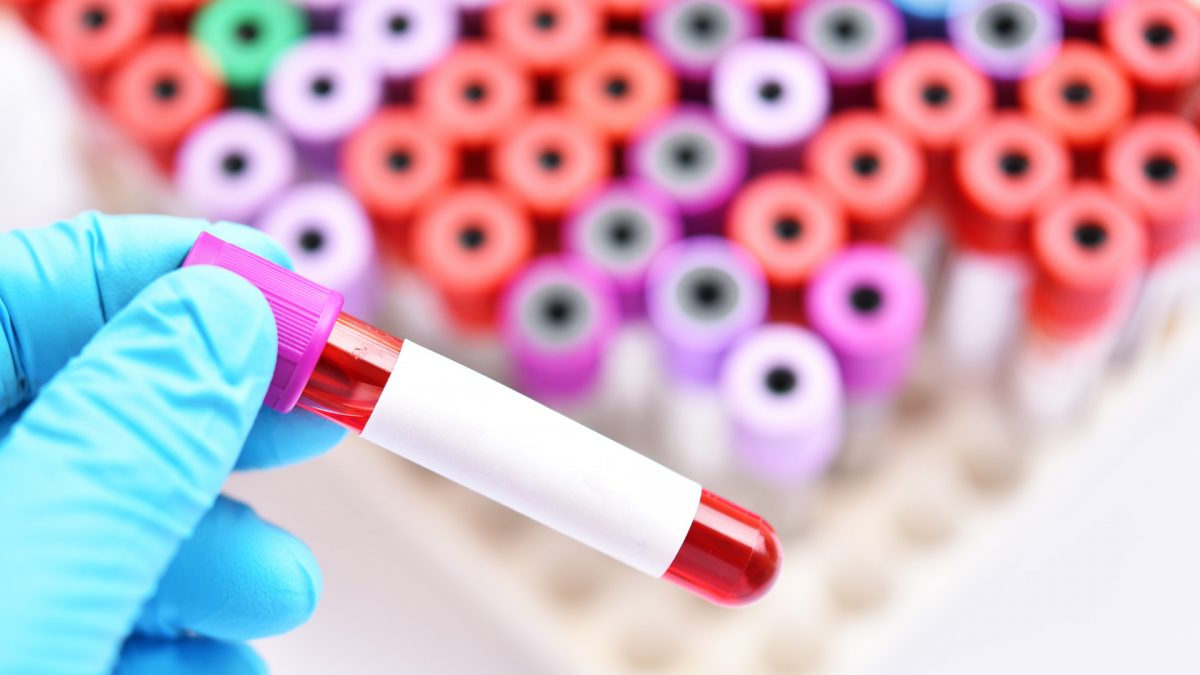 Private prenatal screening: beware of certain tests